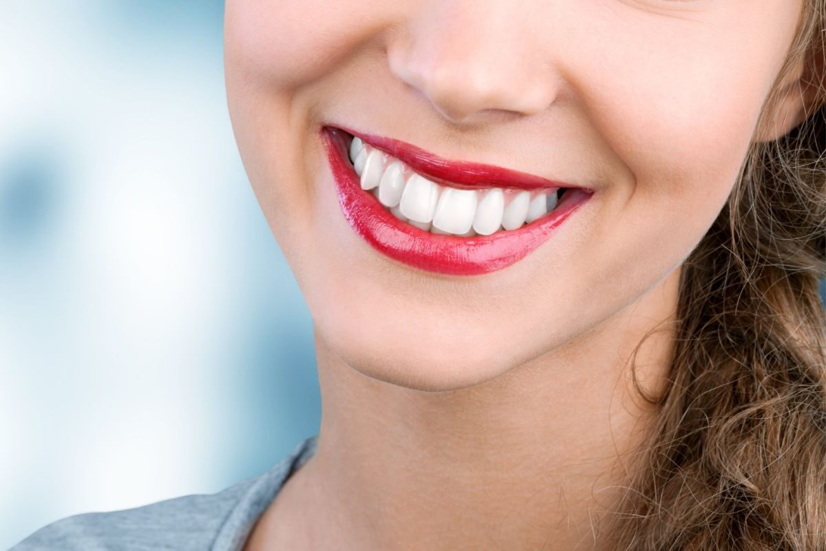 Gülüş Tasarımı İstanbul